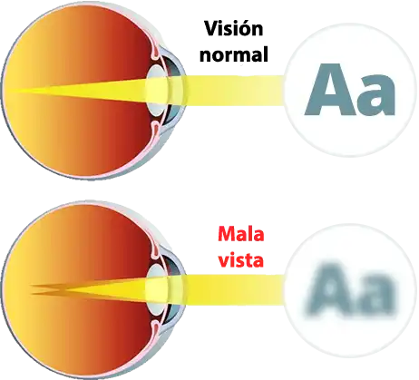 Alt